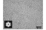 Particles of hexameric protein helicase P4 Individual particles of hexameric protein helicase P4 (210 kDa, 6 nm) stained by uranyl acetate. Lower left corner: 2D single particle analysis of the P4 particles.