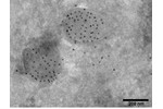 Immunolocalization of a protein using antibody conjugated to gold nanoparticle. Immunolocalization of a protein using antibody conjugated to gold nanoparticle.